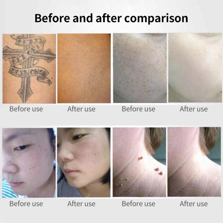 EDA0080443_B7.jpg@9e18763eaf1c62412eaf58b6b1693736